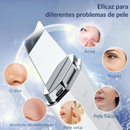 Esfoliador Facial Ultrassônico – Limpeza Profunda e Lifting EMS